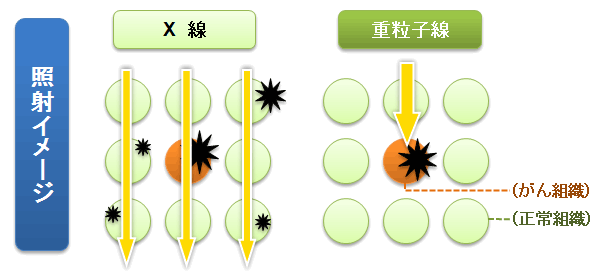 照射イメージ