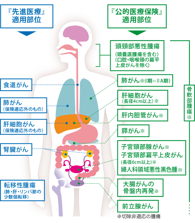 重粒子線がん治療の対象となる部位